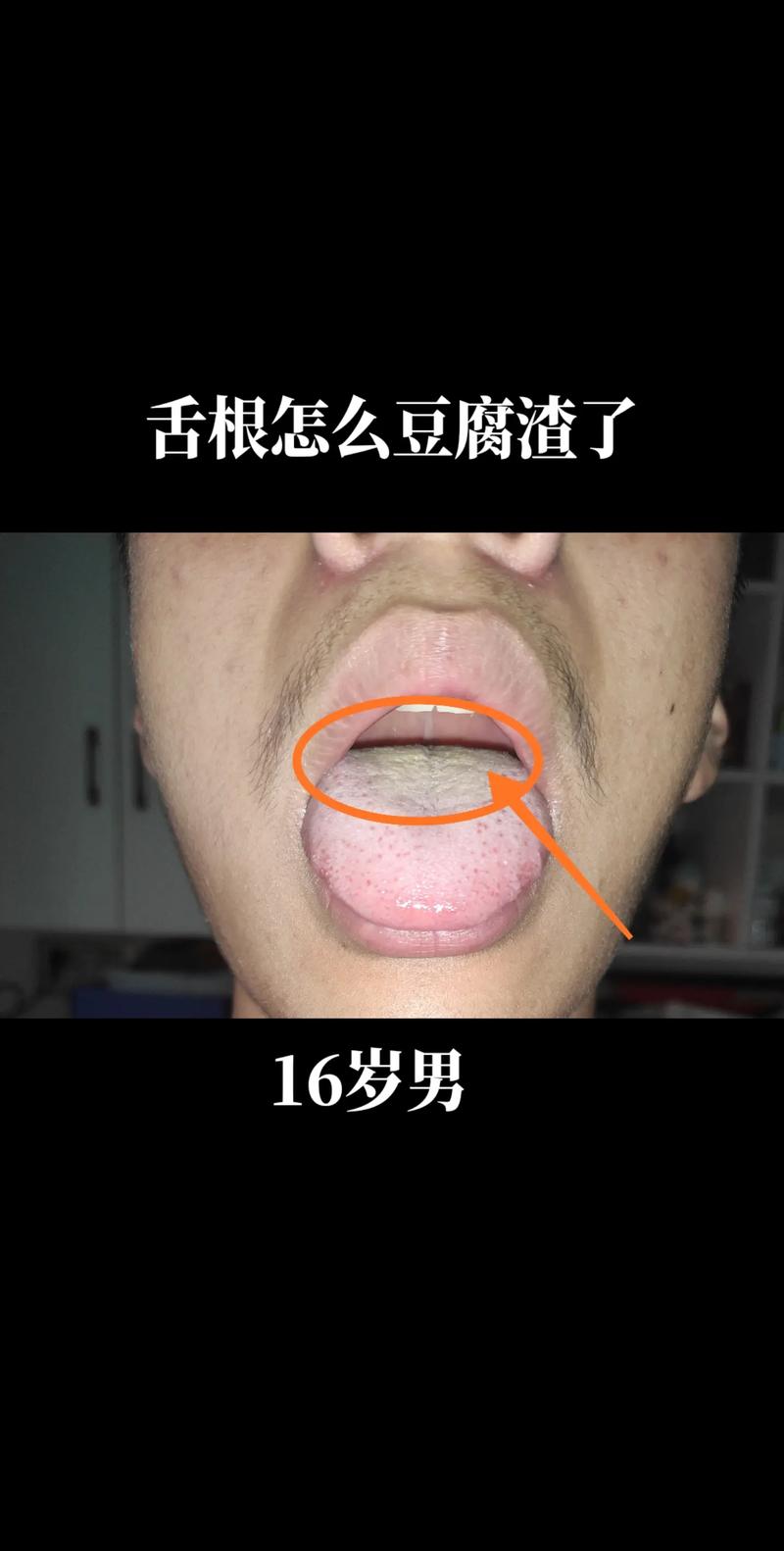 2025年正版资料免费大全和舌根和牙龈被缝一起与舌根和牙龈被缝一起怎么办