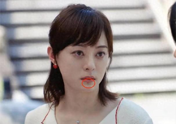 2025天天开彩资料大全免费下载安装和孙俪唇下痣没了与孙俪嘴唇的痣
